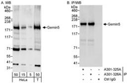 Detection of human Gemin5 by western blot and immunoprecipitation.