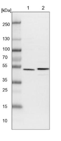 Western Blot: ADCK4 Antibody [NBP1-85508] - Lane 1: NIH-3T3 cell lysate (Mouse embryonic fibroblast cells)<br/>Lane 2: NBT-II cell lysate (Rat Wistar bladder tumour cells)