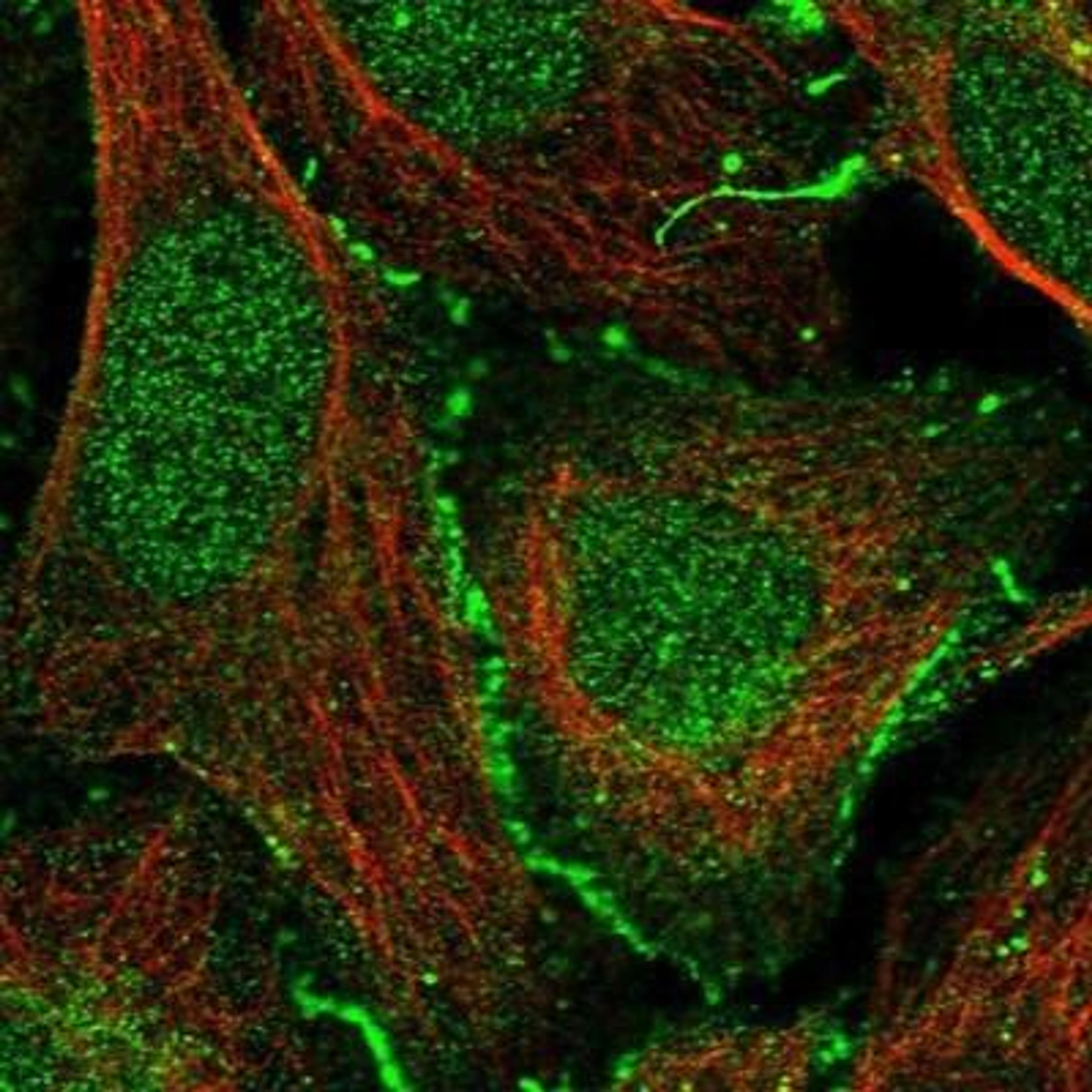 Immunocytochemistry/Immunofluorescence: CXADR Antibody [NBP1-88192] -  Staining of human cell line U-2 OS shows positivity in nucleus but not nucleoli, plasma membrane & cell junctions.