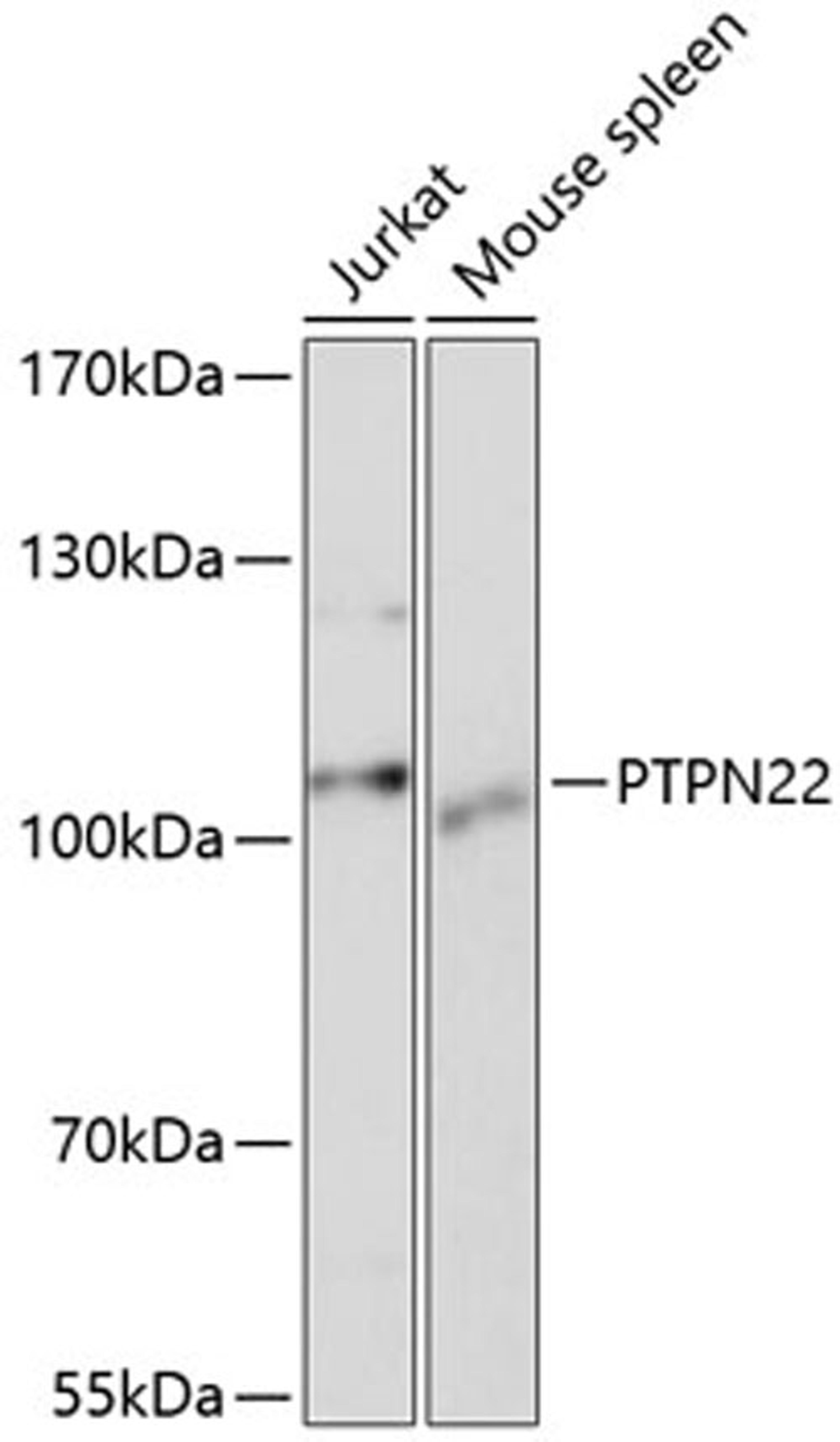 Western blot - PTPN22 antibody (A1406)