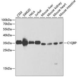 Western blot - C1QBP antibody (A1883)