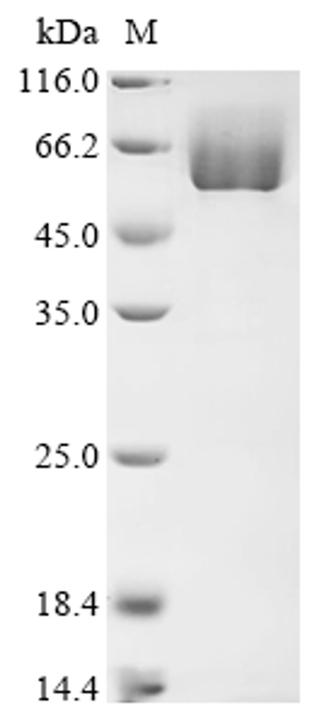 (Tris-Glycine gel) Discontinuous SDS-PAGE (reduced) with 5% enrichment gel and 15% separation gel.