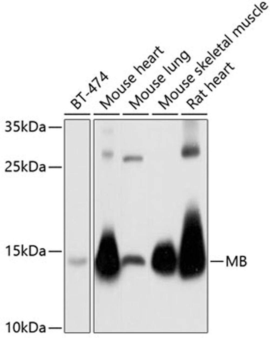 Western blot - MB antibody (A5471)