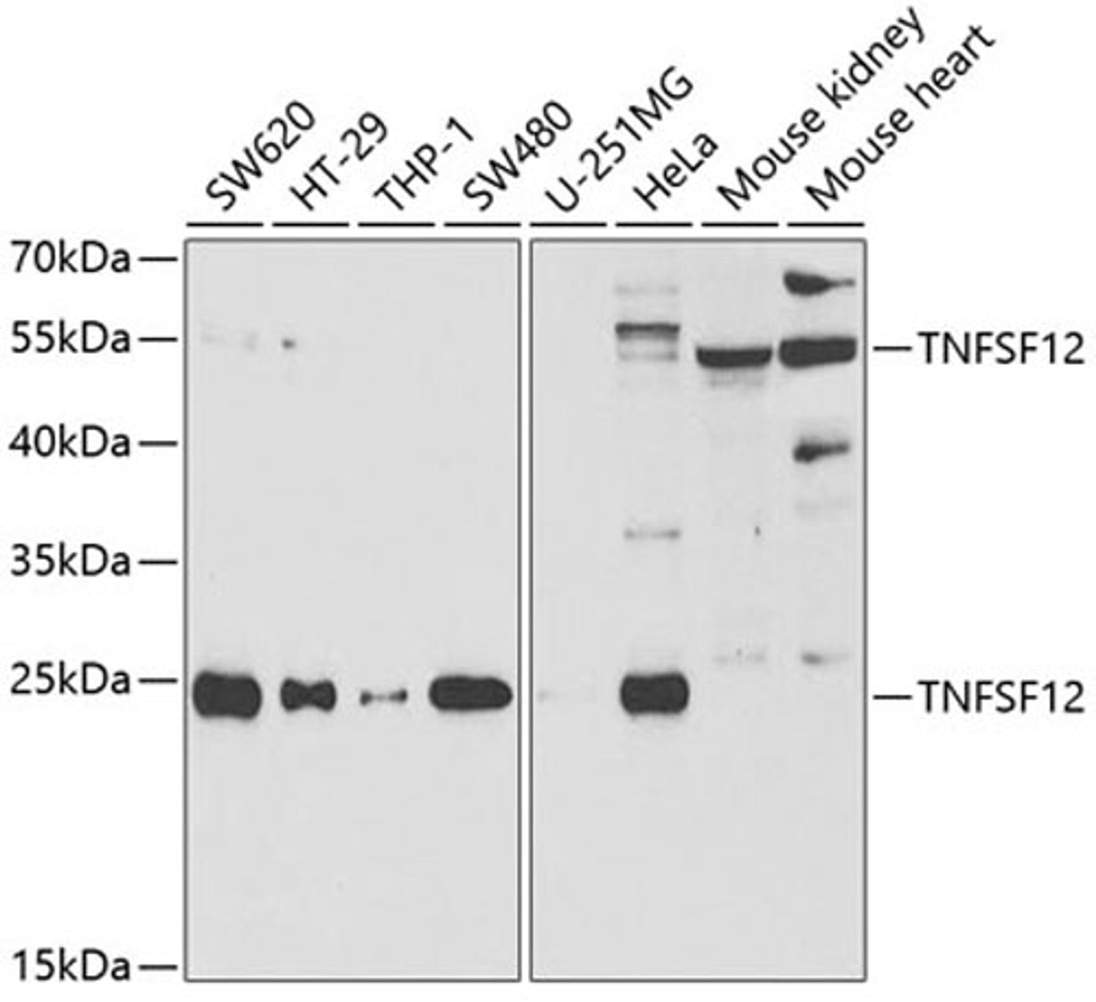 Western blot - TNFSF12 antibody (A5659)