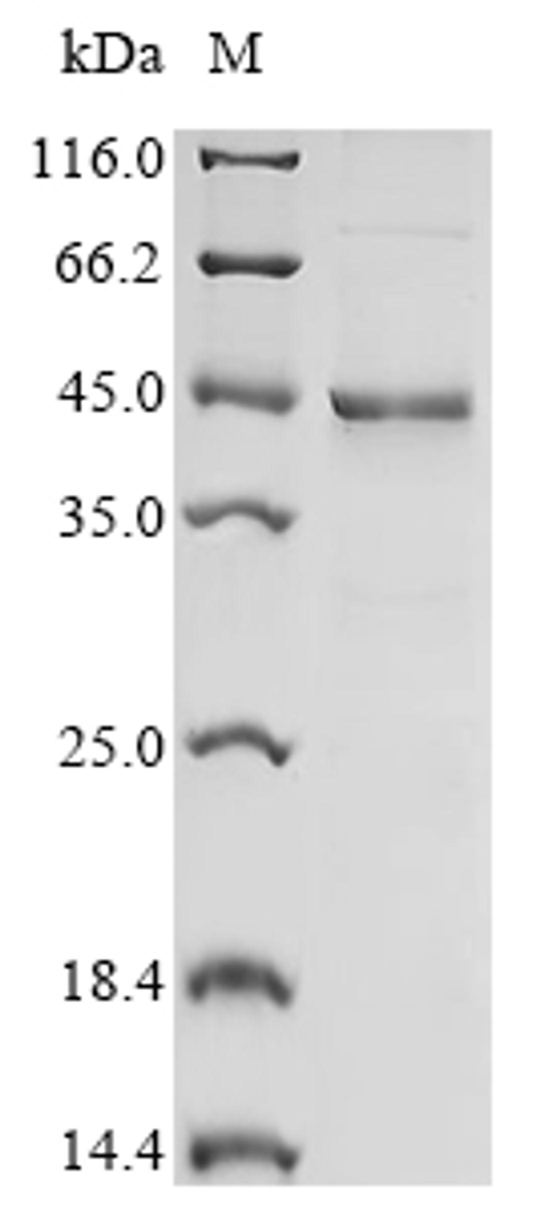 (Tris-Glycine gel) Discontinuous SDS-PAGE (reduced) with 5% enrichment gel and 15% separation gel.