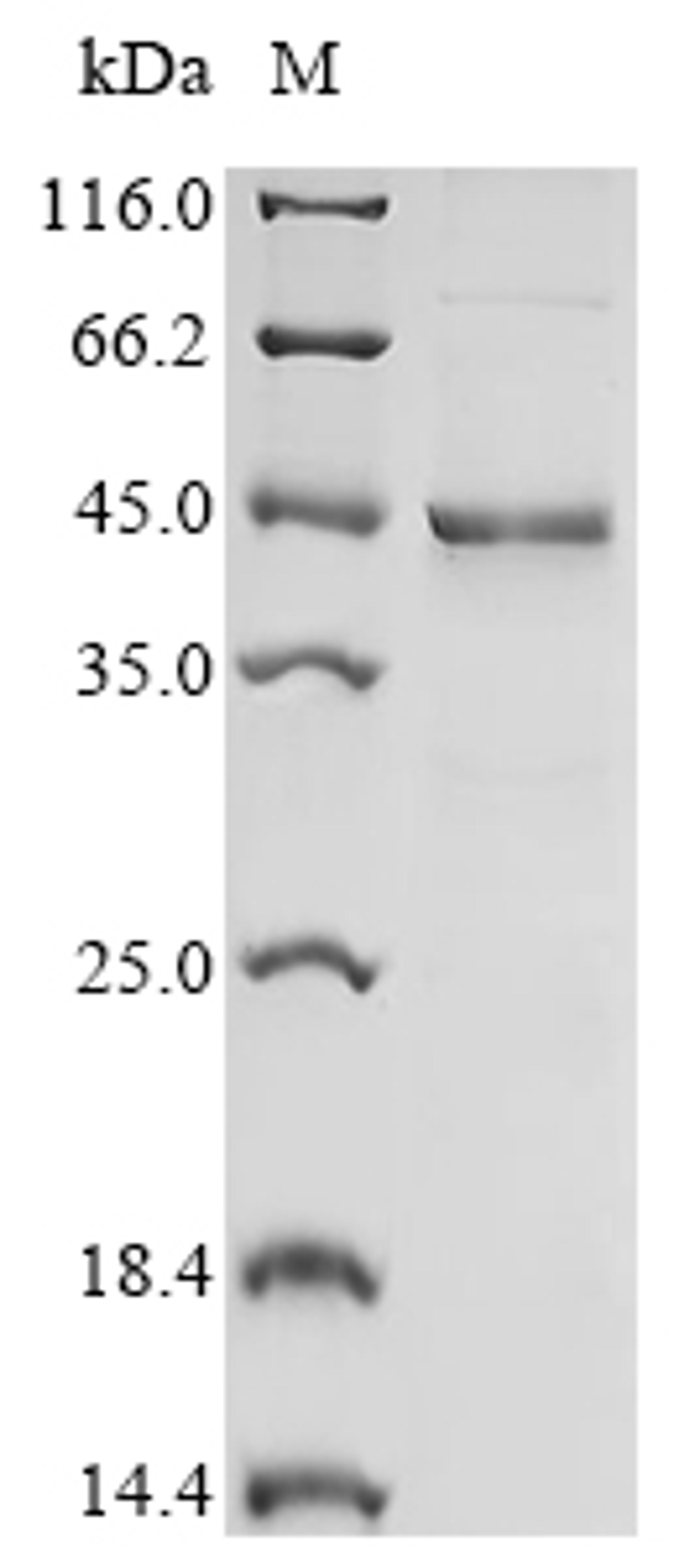 (Tris-Glycine gel) Discontinuous SDS-PAGE (reduced) with 5% enrichment gel and 15% separation gel.
