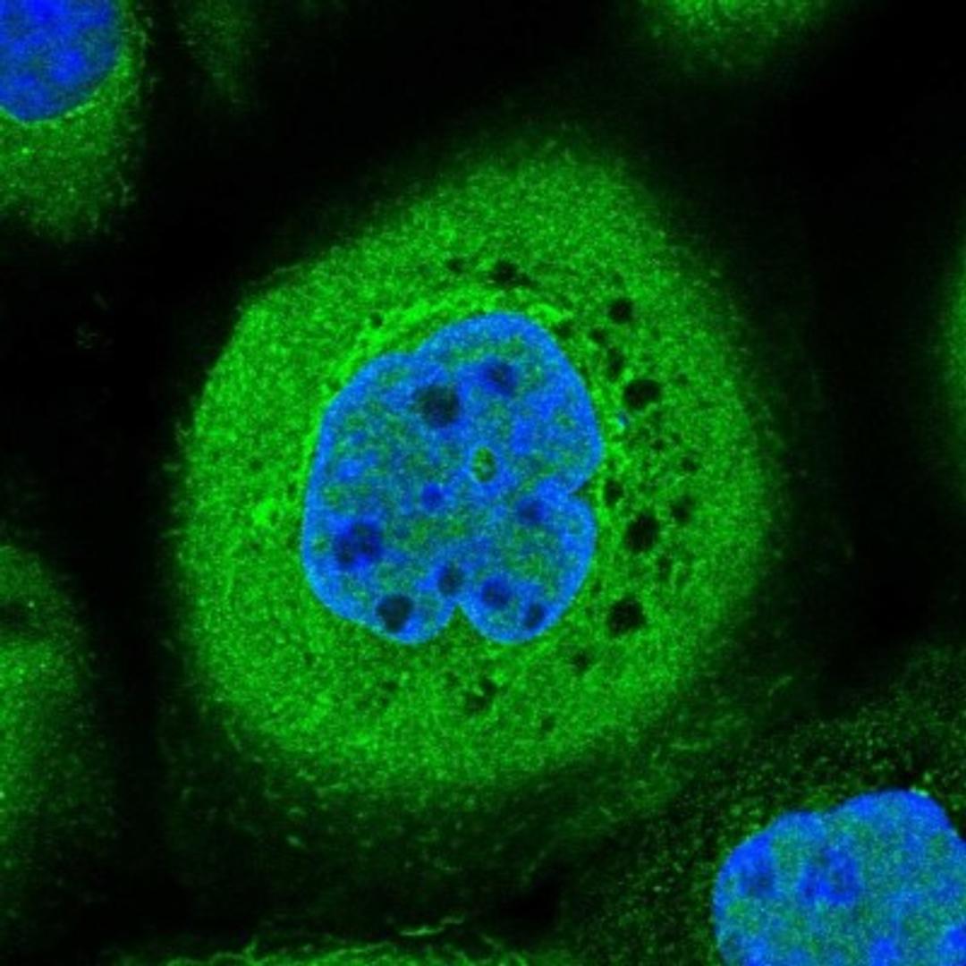 Immunocytochemistry/Immunofluorescence: ZRANB3 Antibody [NBP2-13604] - Staining of human cell line A-431 shows positivity in nucleus but not nucleoli, cytoplasm & golgi apparatus.