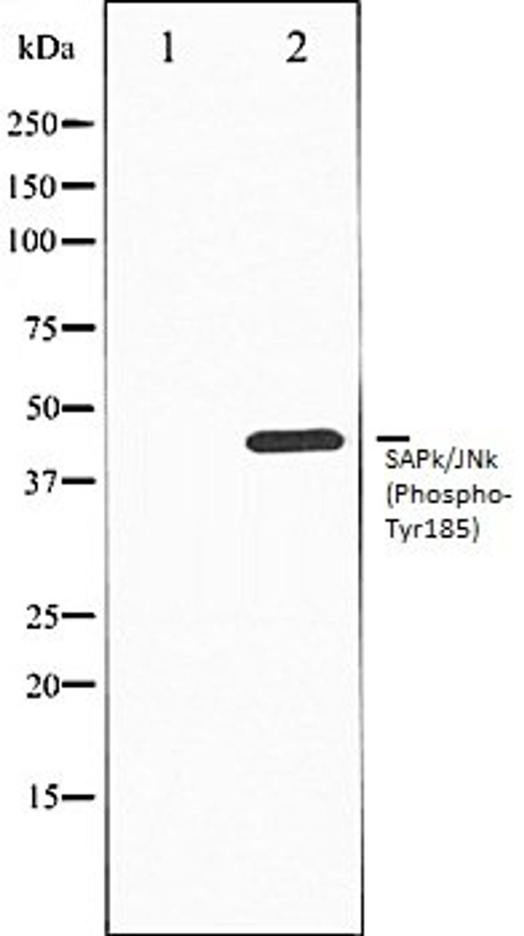 Western blot analysis of HepG2 whole cell lysates using SAPK/JNK (Phospho-Tyr185) antibody, The lane on the left is treated with the antigen-specific peptide.