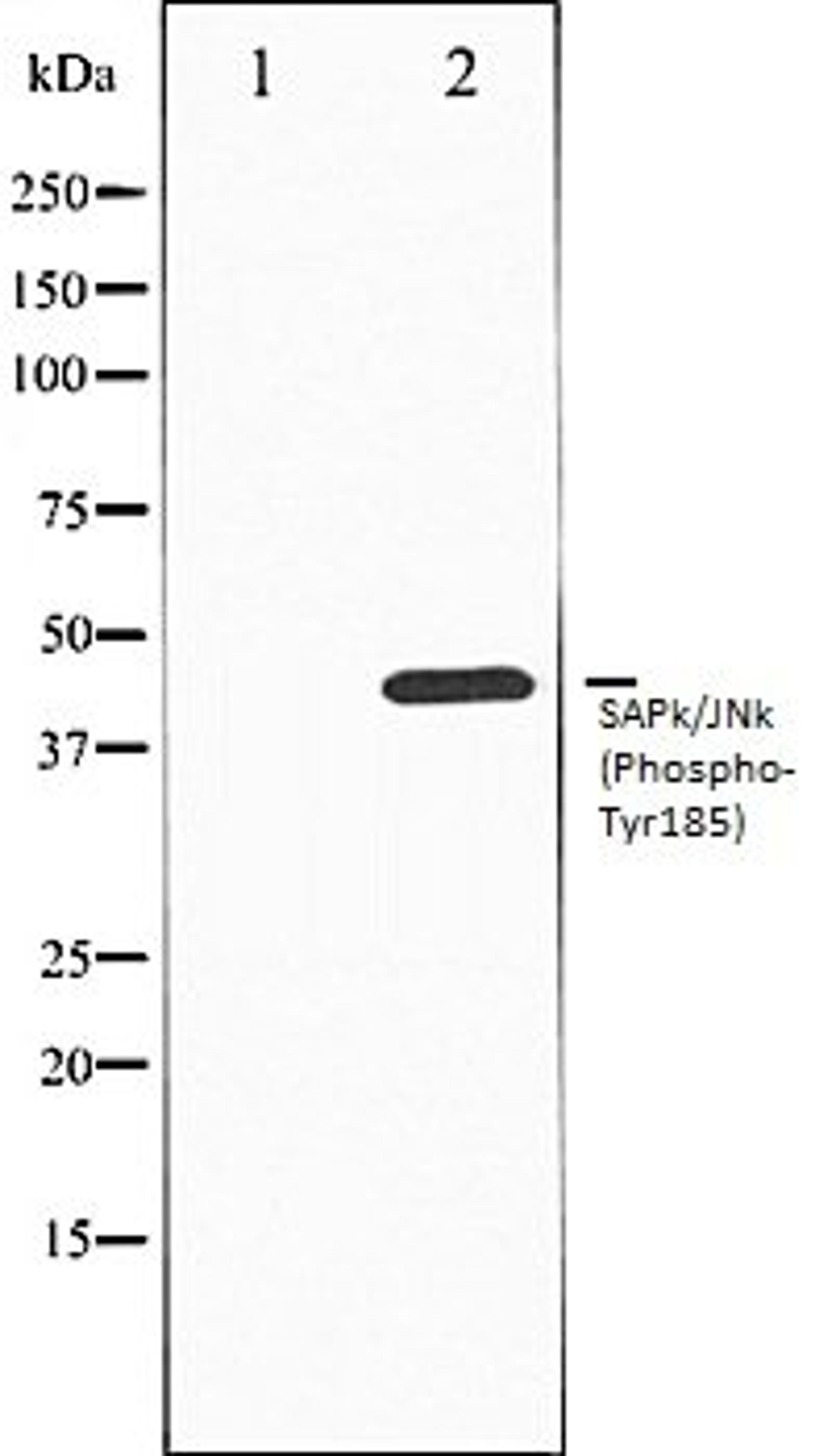 Western blot analysis of HepG2 whole cell lysates using SAPK/JNK (Phospho-Tyr185) antibody, The lane on the left is treated with the antigen-specific peptide.