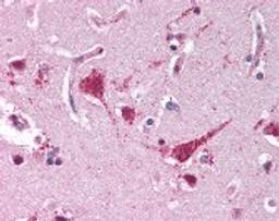 Immunohistochemistry staining of XRCC5 in brain cortex tissue using XRCC5 monoclonal Antibody.