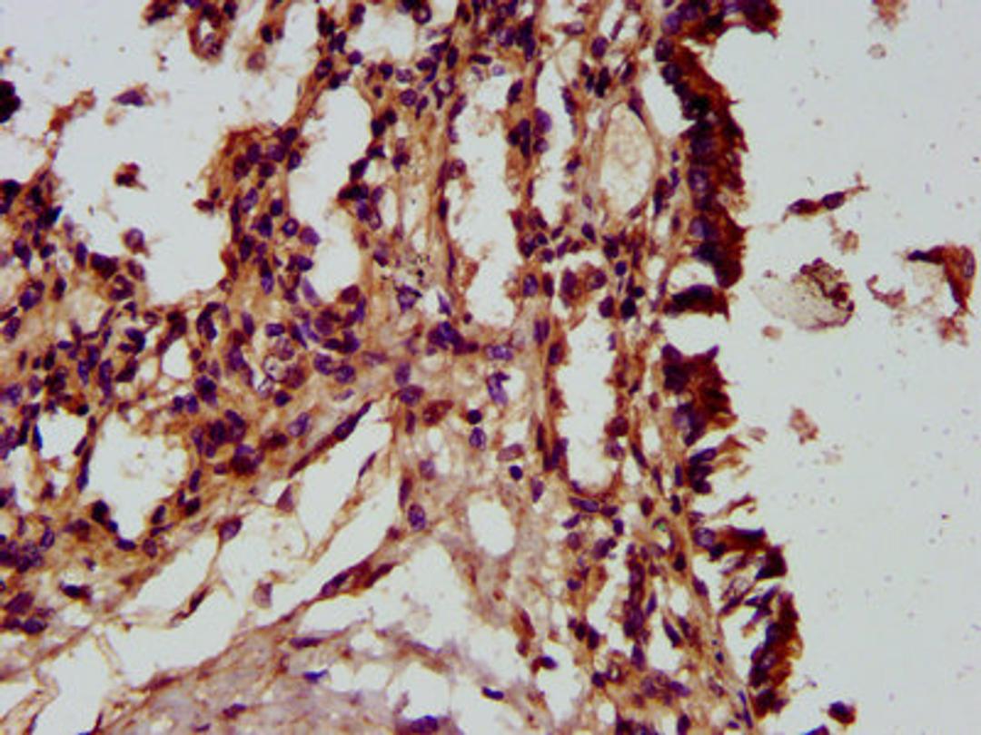 IHC image of CSB-PA732977LA01HU diluted at 1:300 and staining in paraffin-embedded human lung tissue performed on a Leica BondTM system. After dewaxing and hydration, antigen retrieval was mediated by high pressure in a citrate buffer (pH 6.0). Section was blocked with 10% normal goat serum 30min at RT. Then primary antibody (1% BSA) was incubated at 4&deg;C overnight. The primary is detected by a biotinylated secondary antibody and visualized using an HRP conjugated SP system.