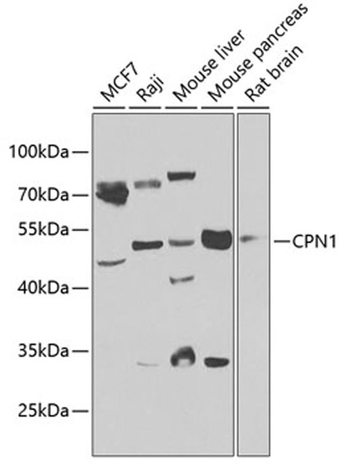 Western blot - CPN1 antibody (A7887)