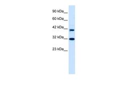 Antibody used in WB on Human HepG2 at 0.2-1 ug/ml.