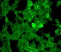 Immunofluorescence analysis of Human Embryonic Kidney cells (HEK 293 cells) using Beta-2-Microglobulin antibody