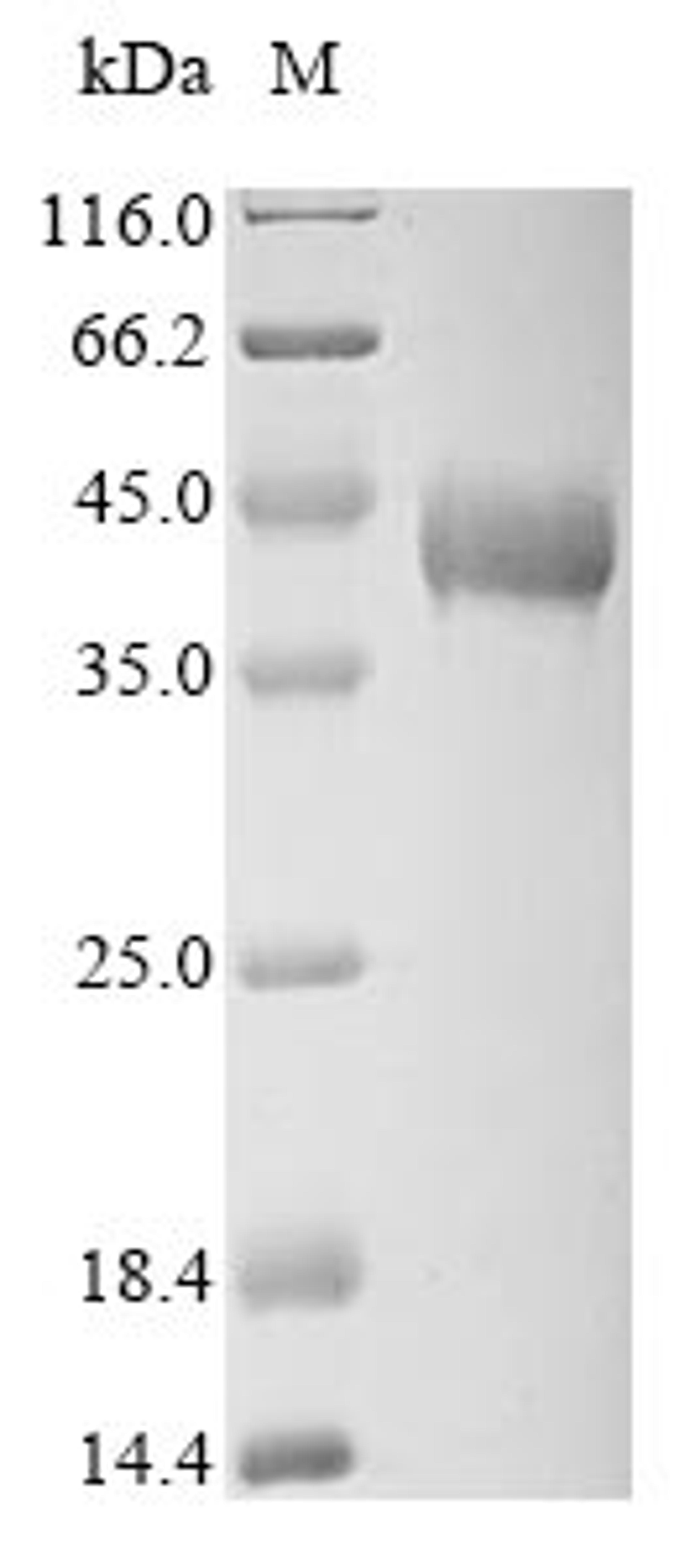 (Tris-Glycine gel) Discontinuous SDS-PAGE (reduced) with 5% enrichment gel and 15% separation gel.