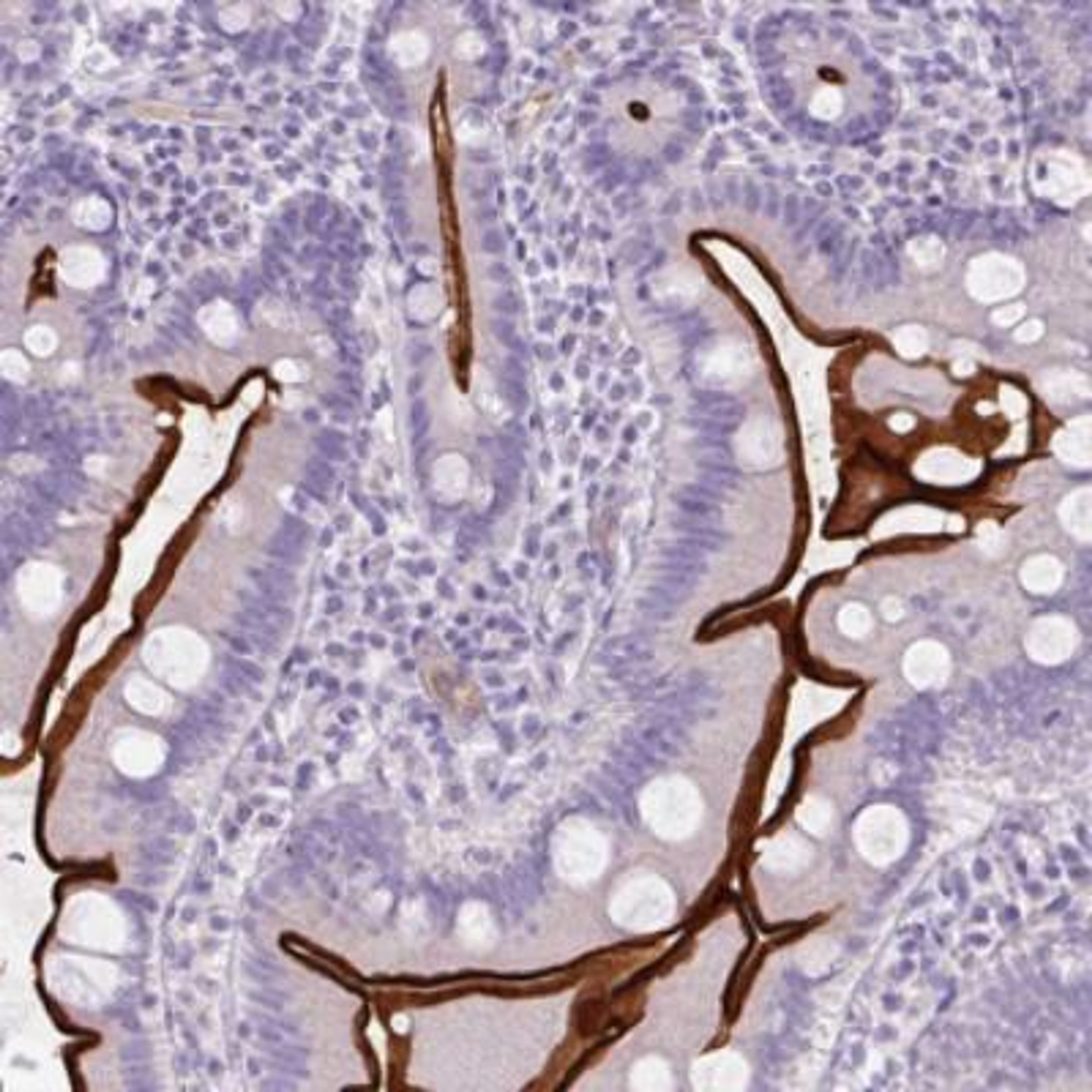 Immunohistochemistry-Paraffin: R-Spondin 4 Antibody [NBP2-30540] - Human small intestine.