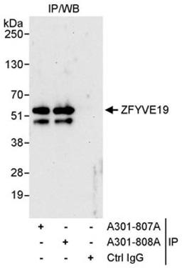 Detection of human ZFYVE19 by western blot of immunoprecipitates.