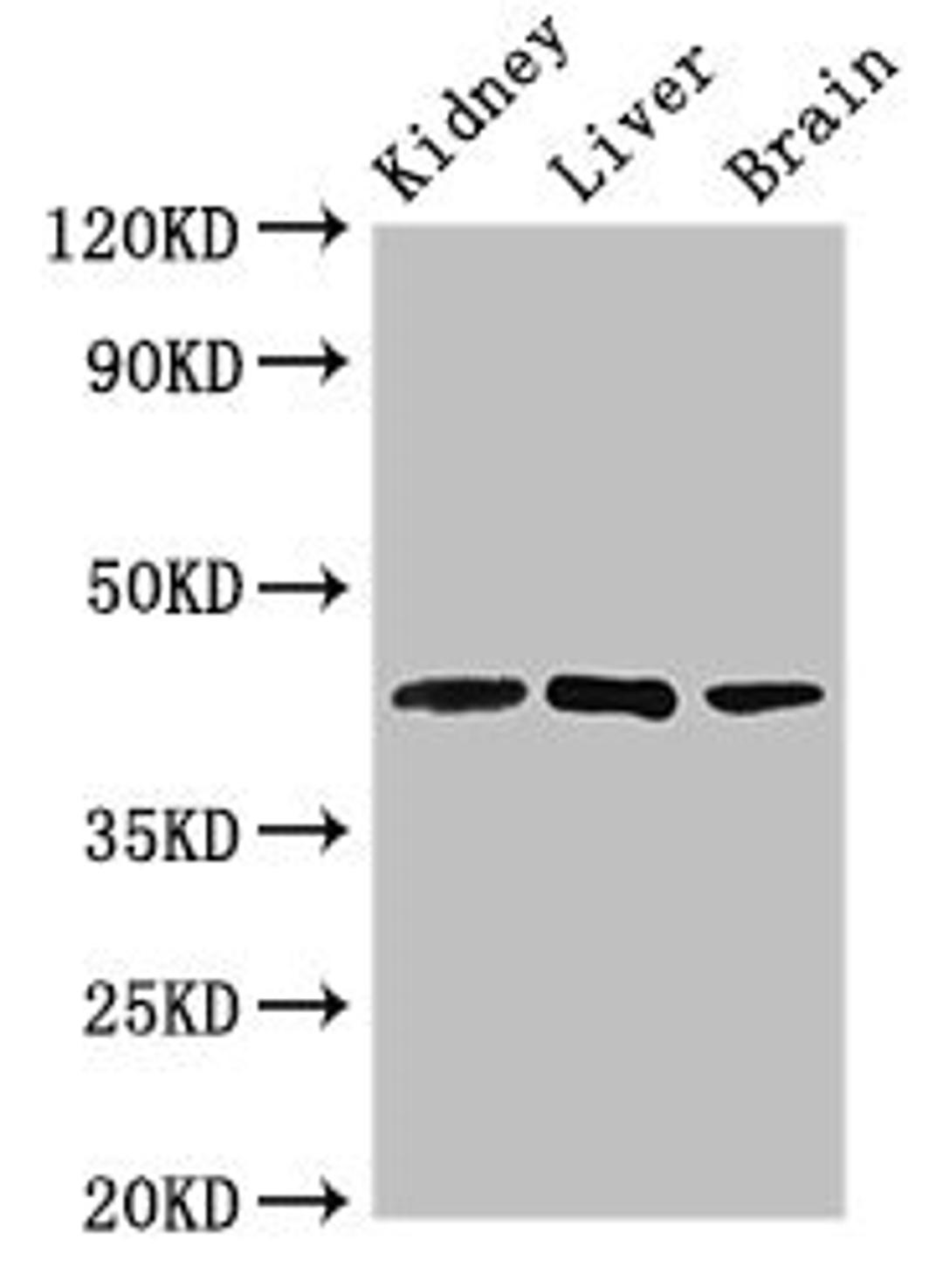Western Blot. Positive WB detected in: Mouse kidney tissue, Rat liver tissue, Rat brain tissue. All lanes: KLF12 antibody at 2.5ug/ml. Secondary. Goat polyclonal to rabbit IgG at 1/50000 dilution. Predicted band size: 45, 29, 34 kDa. Observed band size: 45 kDa. 