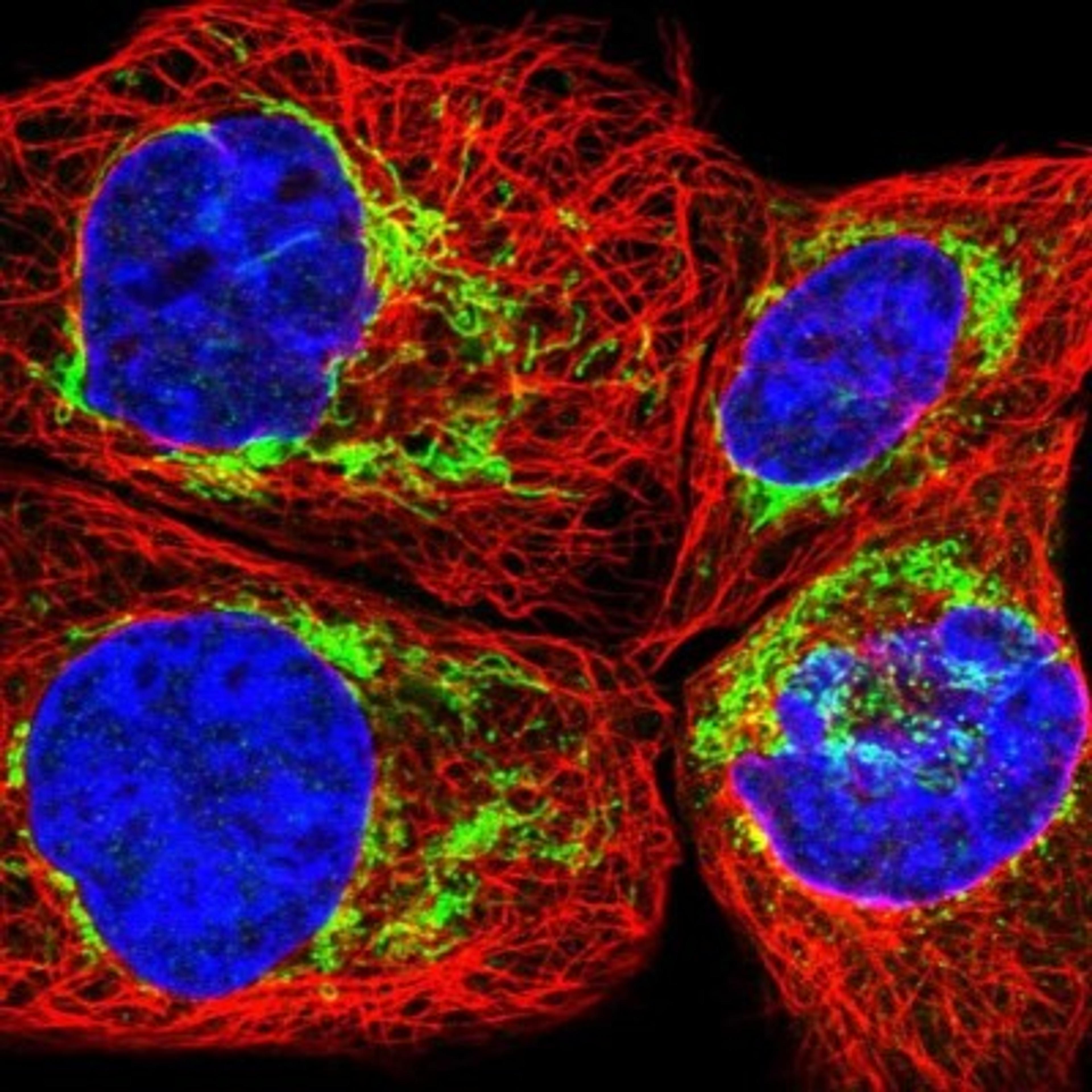 Immunocytochemistry/Immunofluorescence: FAM92A1 Antibody [NBP1-93794] - Staining of human cell line A-431 shows positivity in mitochondria.