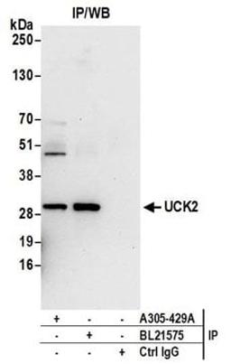 Detection of human UCK2 by western blot of immunoprecipitates.