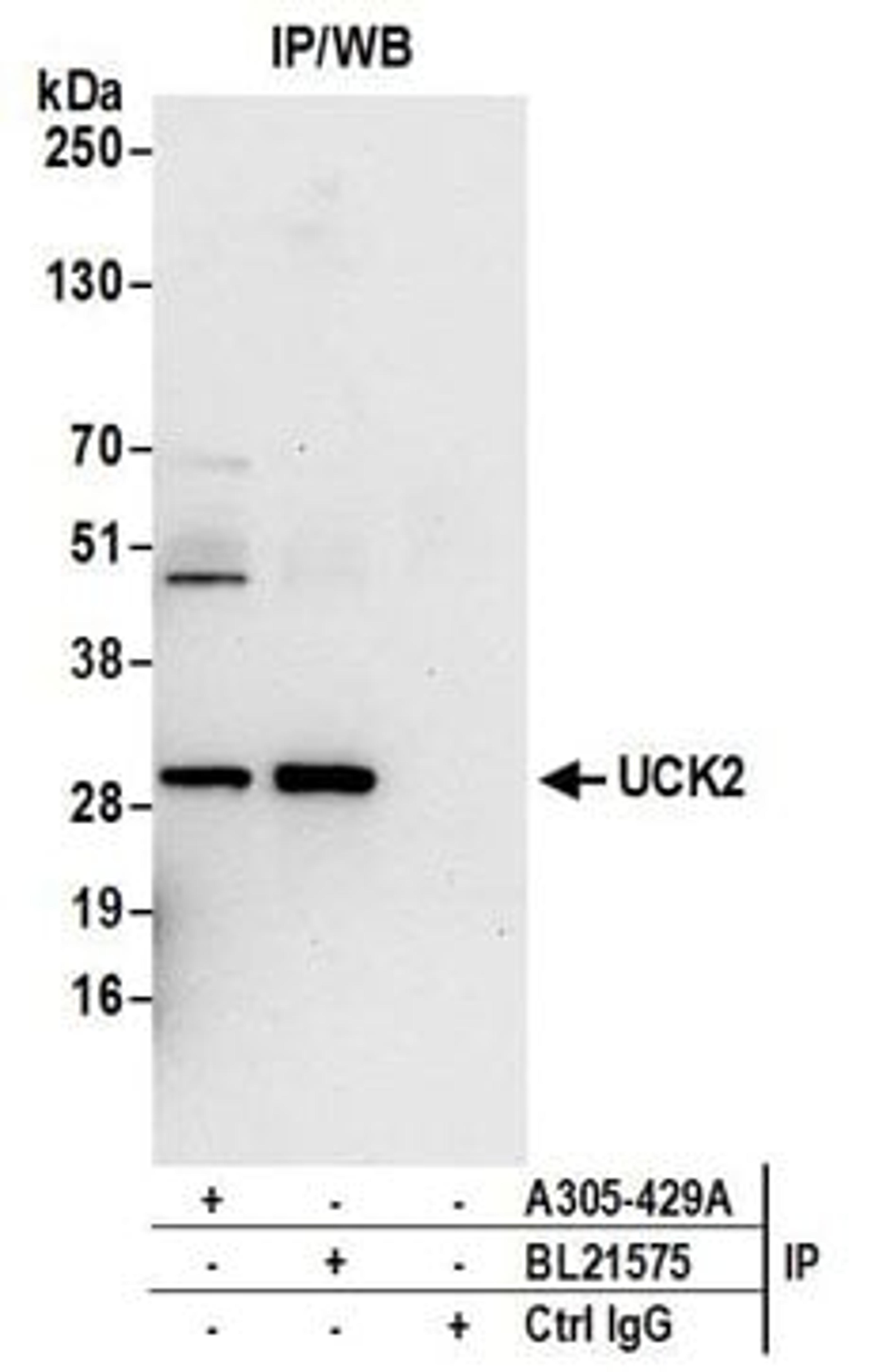 Detection of human UCK2 by western blot of immunoprecipitates.