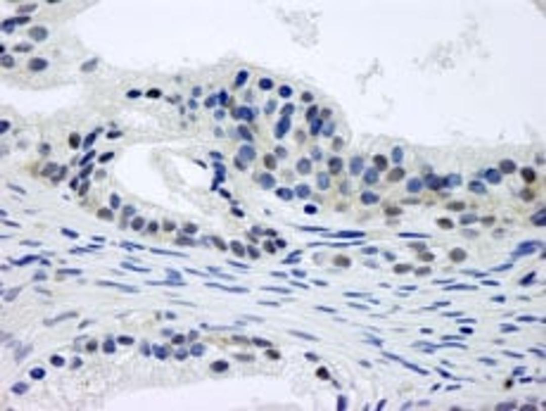 Detection of human CSN1 by immunohistochemistry.