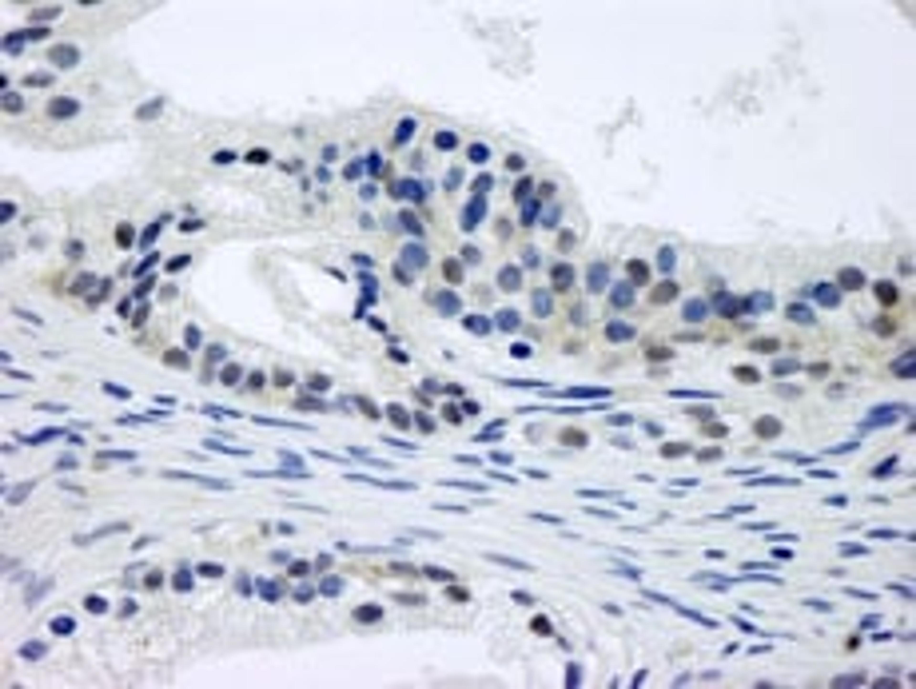 Detection of human CSN1 by immunohistochemistry.