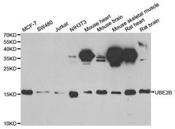 Western blot analysis of extracts of various cell lines using UBE2B antibody