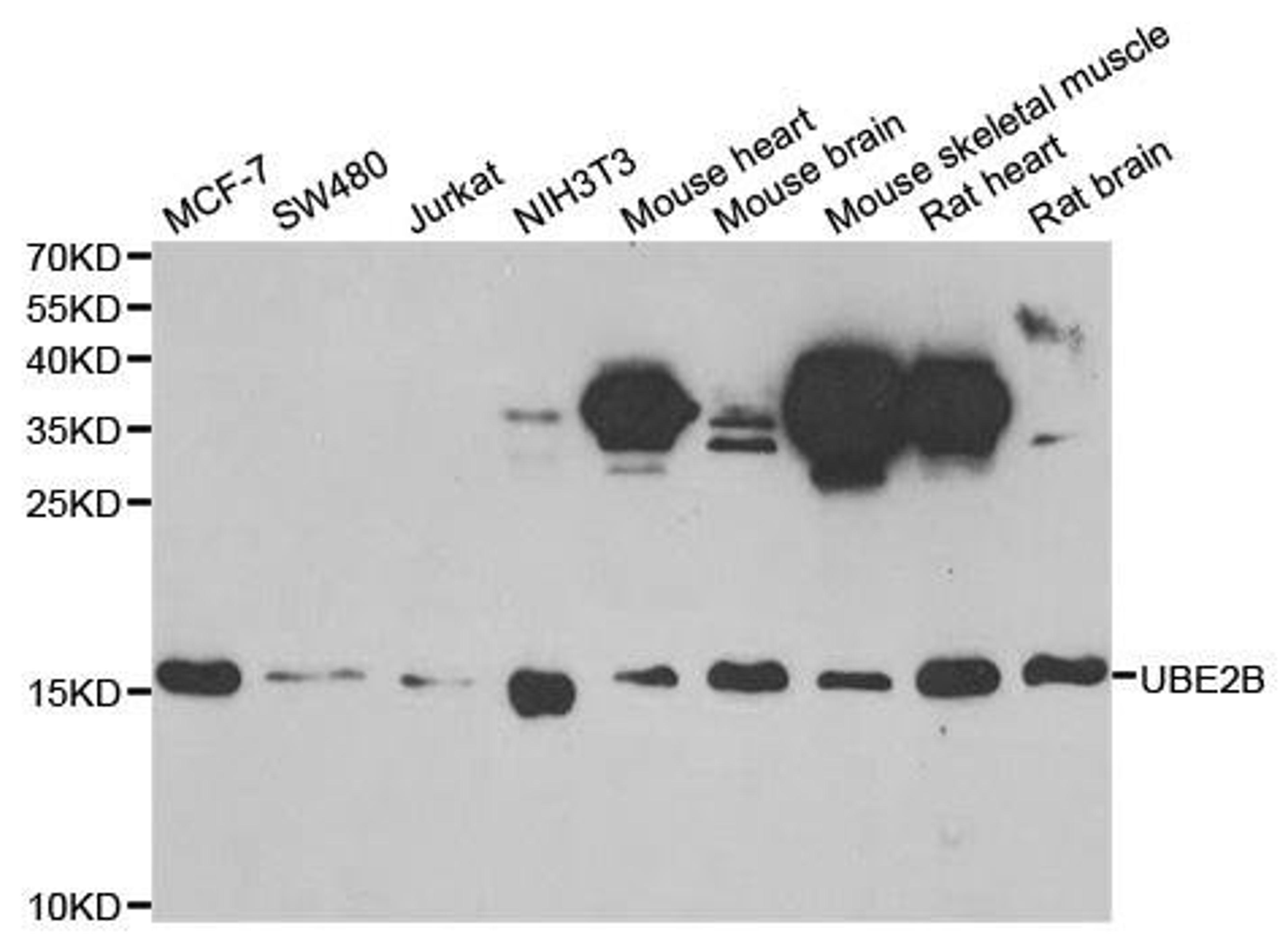 Western blot analysis of extracts of various cell lines using UBE2B antibody