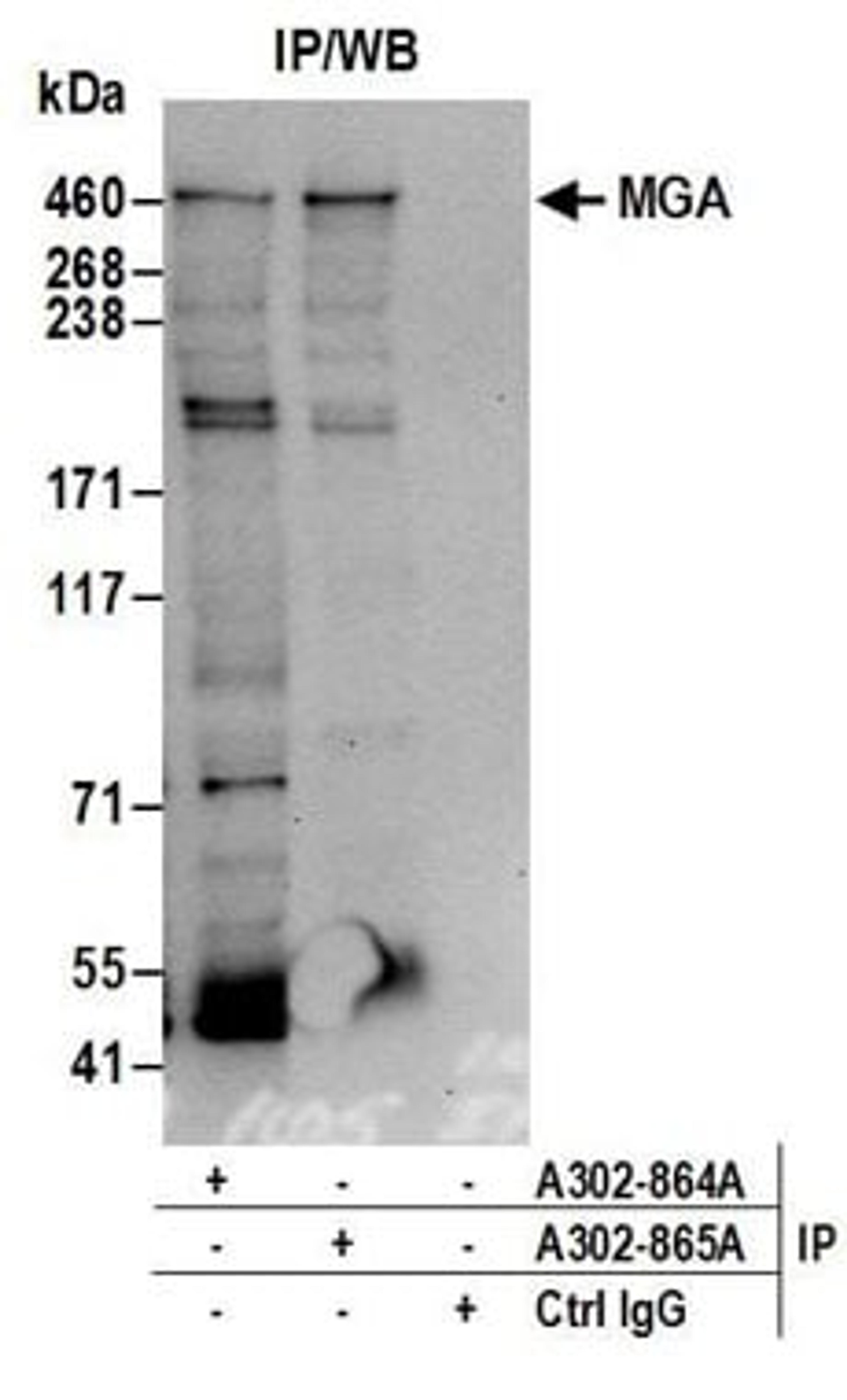 Detection of human MGA by western blot of immunoprecipitates.