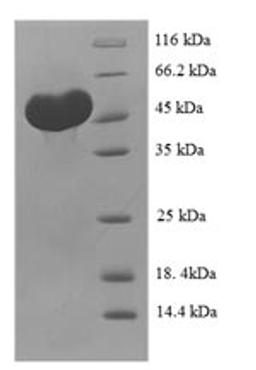 (Tris-Glycine gel) Discontinuous SDS-PAGE (reduced) with 5% enrichment gel and 15% separation gel.