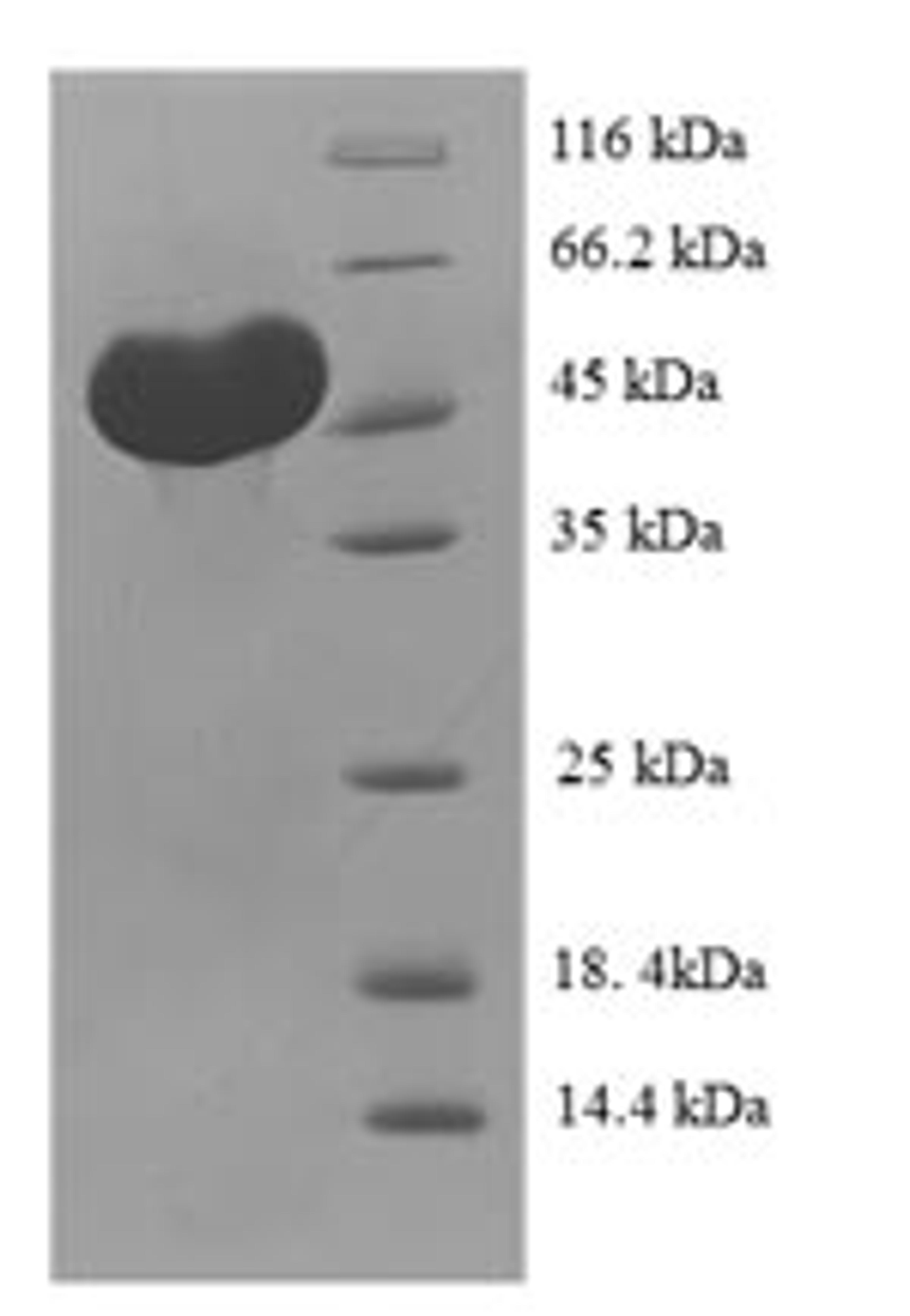 (Tris-Glycine gel) Discontinuous SDS-PAGE (reduced) with 5% enrichment gel and 15% separation gel.