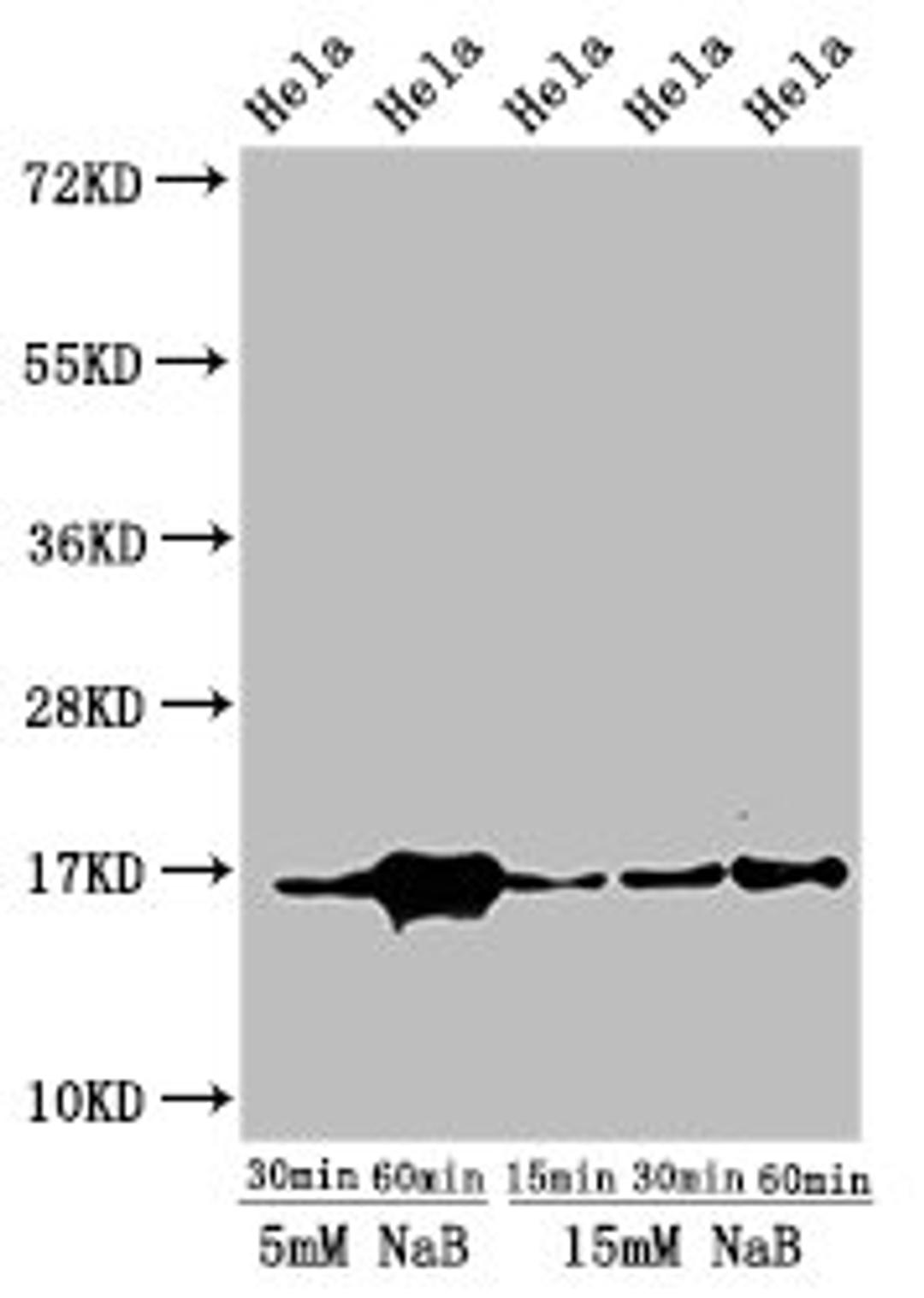 Western Blot. Positive WB detected in: Hela cell acid extracts treated by NaB. All lanes: HIST1H3A antibody at 1µg/ml. Secondary. Goat polyclonal to rabbit IgG at 1/50000 dilution. Predicted band size: 16 kDa. Observed band size: 16 kDa