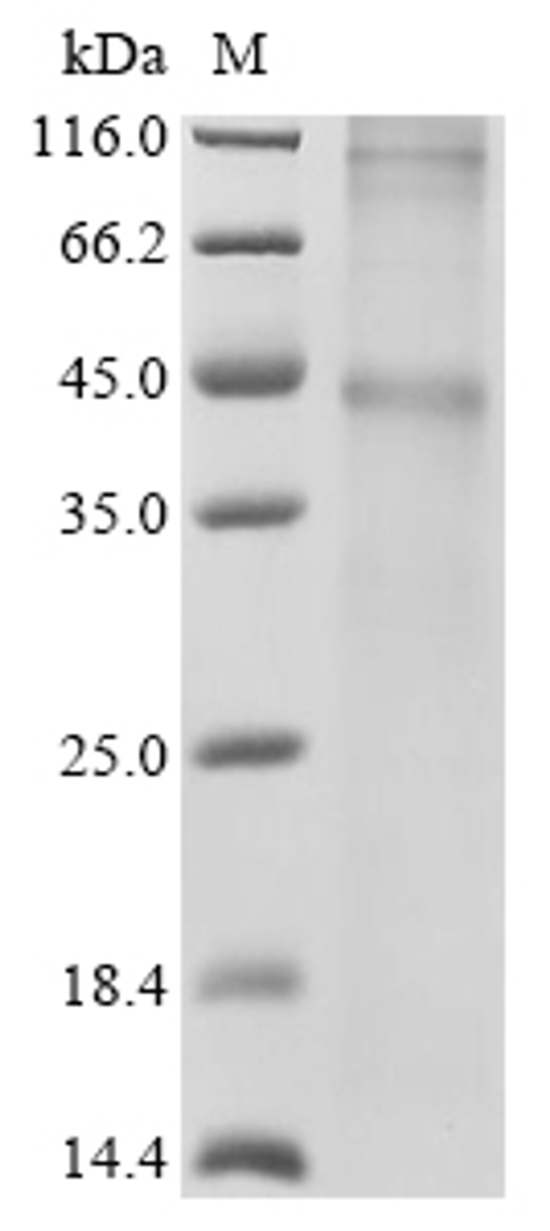 (Tris-Glycine gel) Discontinuous SDS-PAGE (reduced) with 5% enrichment gel and 15% separation gel.