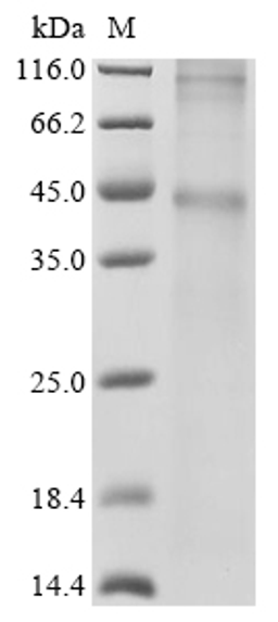 (Tris-Glycine gel) Discontinuous SDS-PAGE (reduced) with 5% enrichment gel and 15% separation gel.