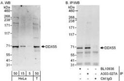 Detection of human DDX55 by western blot and immunoprecipitation.