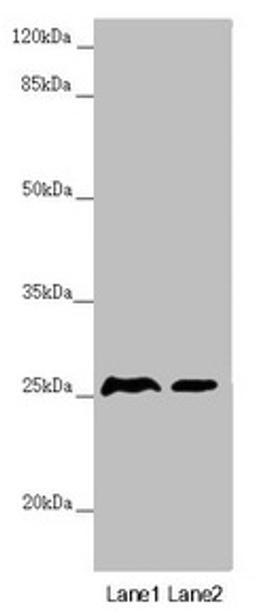 Western blot. All lanes: RNF114 antibody at 0.87µg/ml. Lane 1: Mouse gonadal tissue. Lane 2: 293T whole cell lysate. Secondary. Goat polyclonal to rabbit IgG at 1/10000 dilution. Predicted band size: 26, 22 kDa. Observed band size: 26 kDa