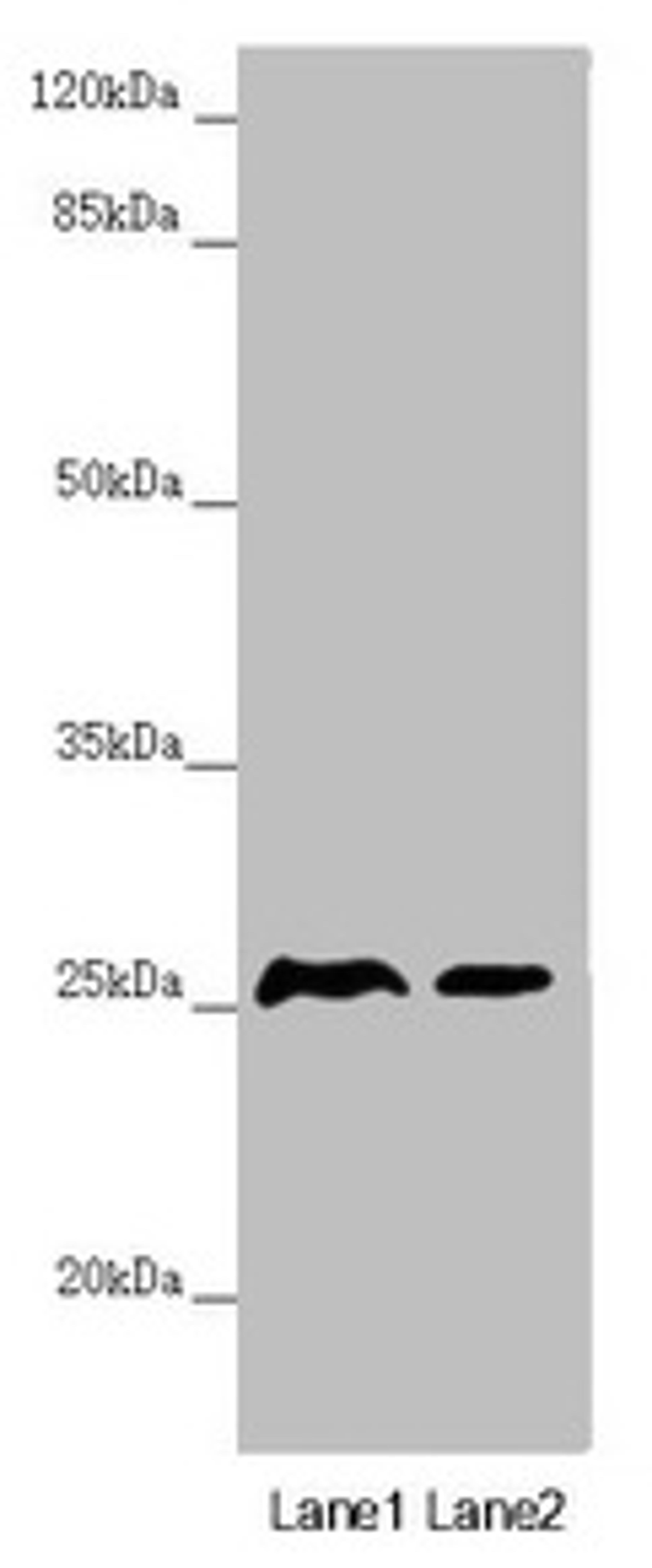 Western blot. All lanes: RNF114 antibody at 0.87µg/ml. Lane 1: Mouse gonadal tissue. Lane 2: 293T whole cell lysate. Secondary. Goat polyclonal to rabbit IgG at 1/10000 dilution. Predicted band size: 26, 22 kDa. Observed band size: 26 kDa