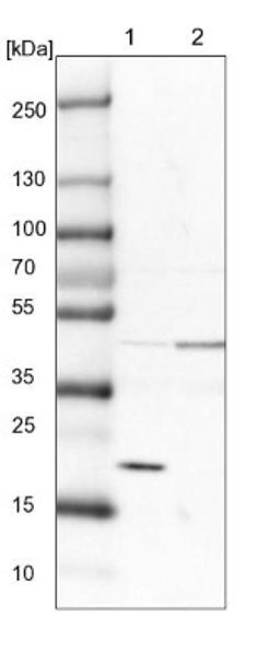 Western Blot: SRP19 Antibody [NBP1-89507] - Lane 1: NIH-3T3 cell lysate (Mouse embryonic fibroblast cells)<br/>Lane 2: NBT-II cell lysate (Rat Wistar bladder tumour cells)