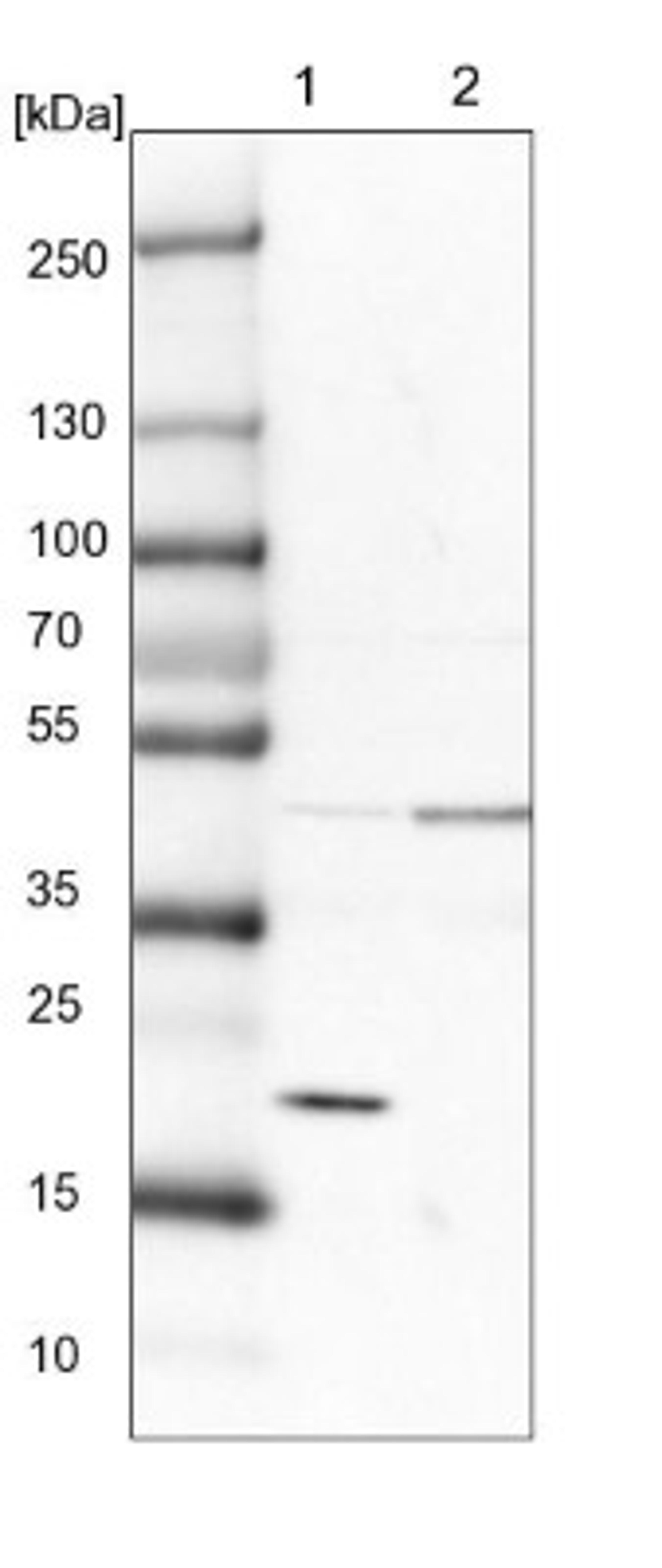 Western Blot: SRP19 Antibody [NBP1-89507] - Lane 1: NIH-3T3 cell lysate (Mouse embryonic fibroblast cells)<br/>Lane 2: NBT-II cell lysate (Rat Wistar bladder tumour cells)