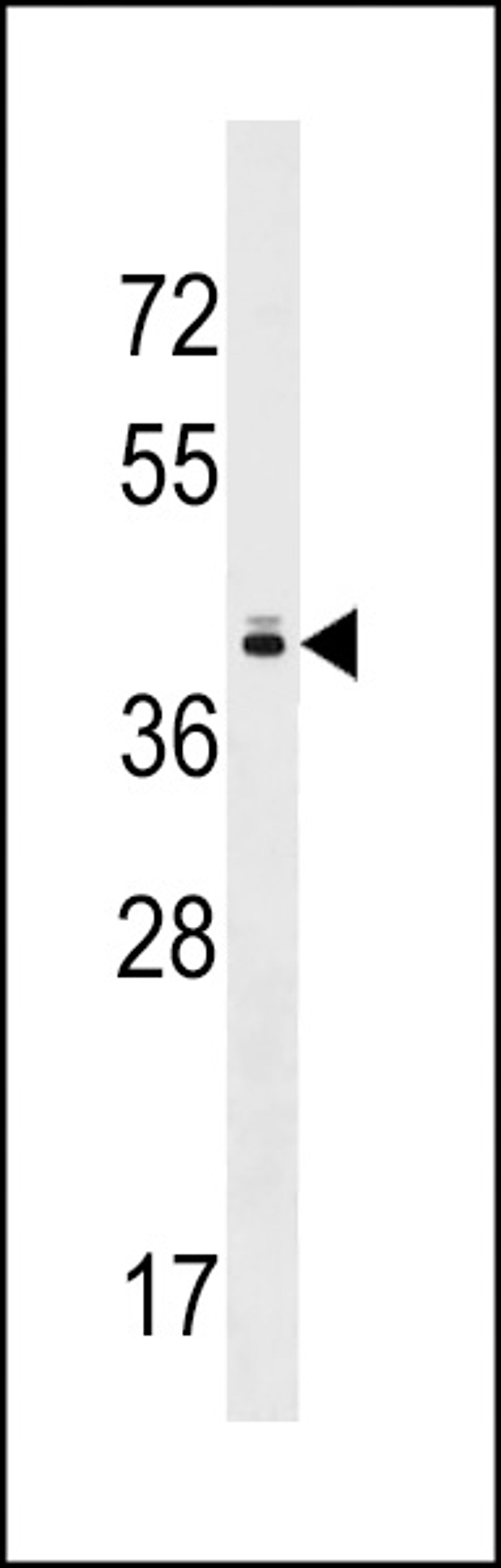 Western blot analysis in MDA-MB453 cell line lysates (35ug/lane).