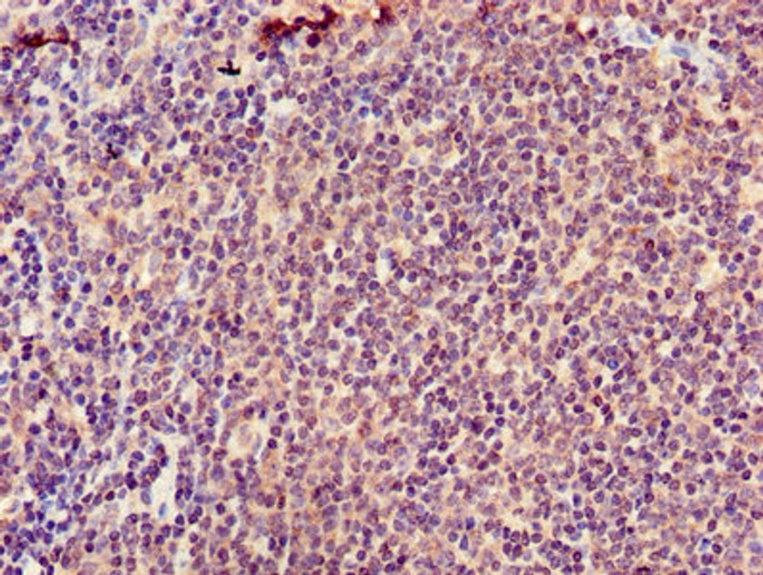 Immunohistochemistry of paraffin-embedded human lymph node tissue using CSB-PA002299LA01HU at dilution of 1:100