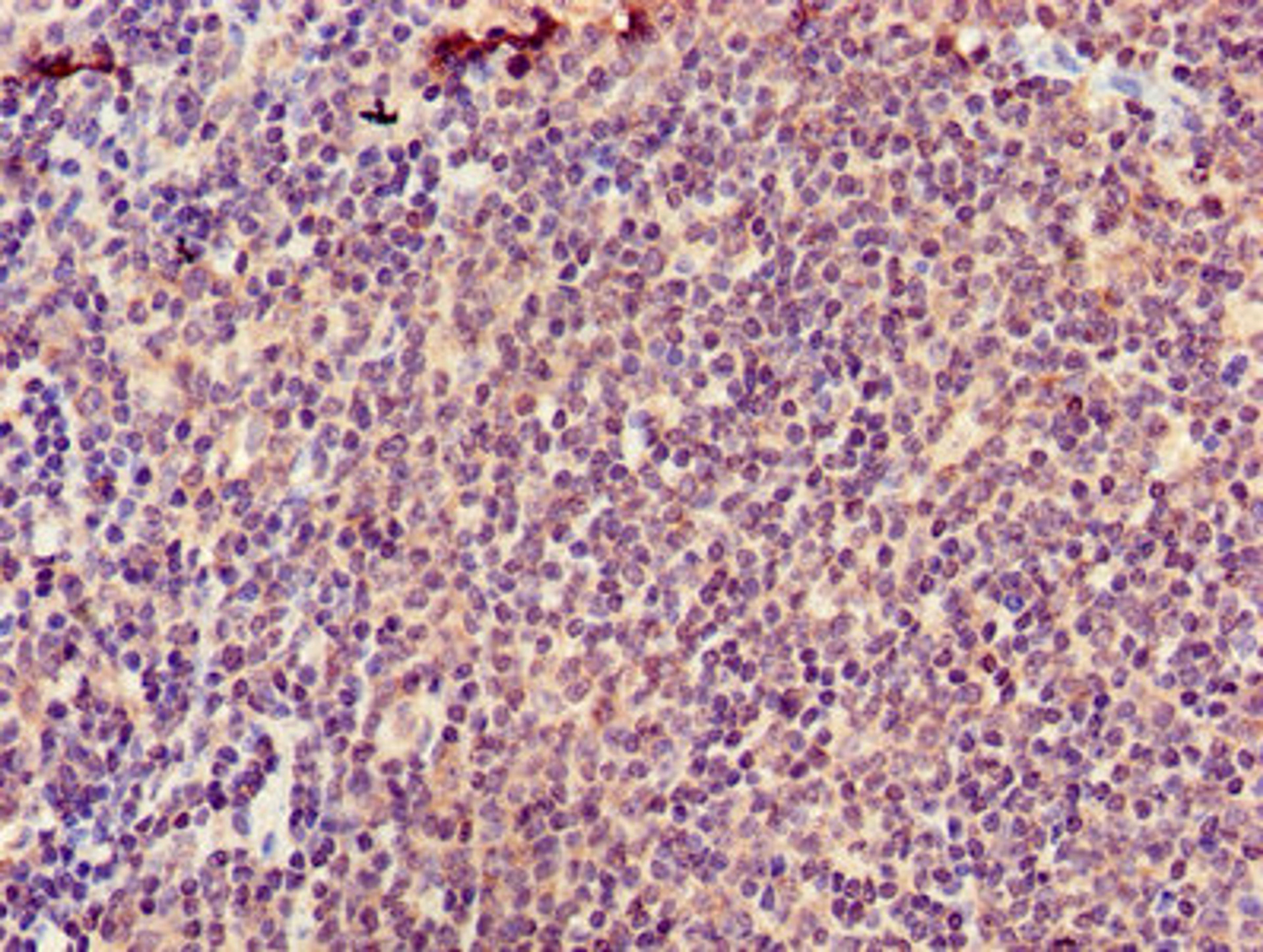 Immunohistochemistry of paraffin-embedded human lymph node tissue using CSB-PA002299LA01HU at dilution of 1:100