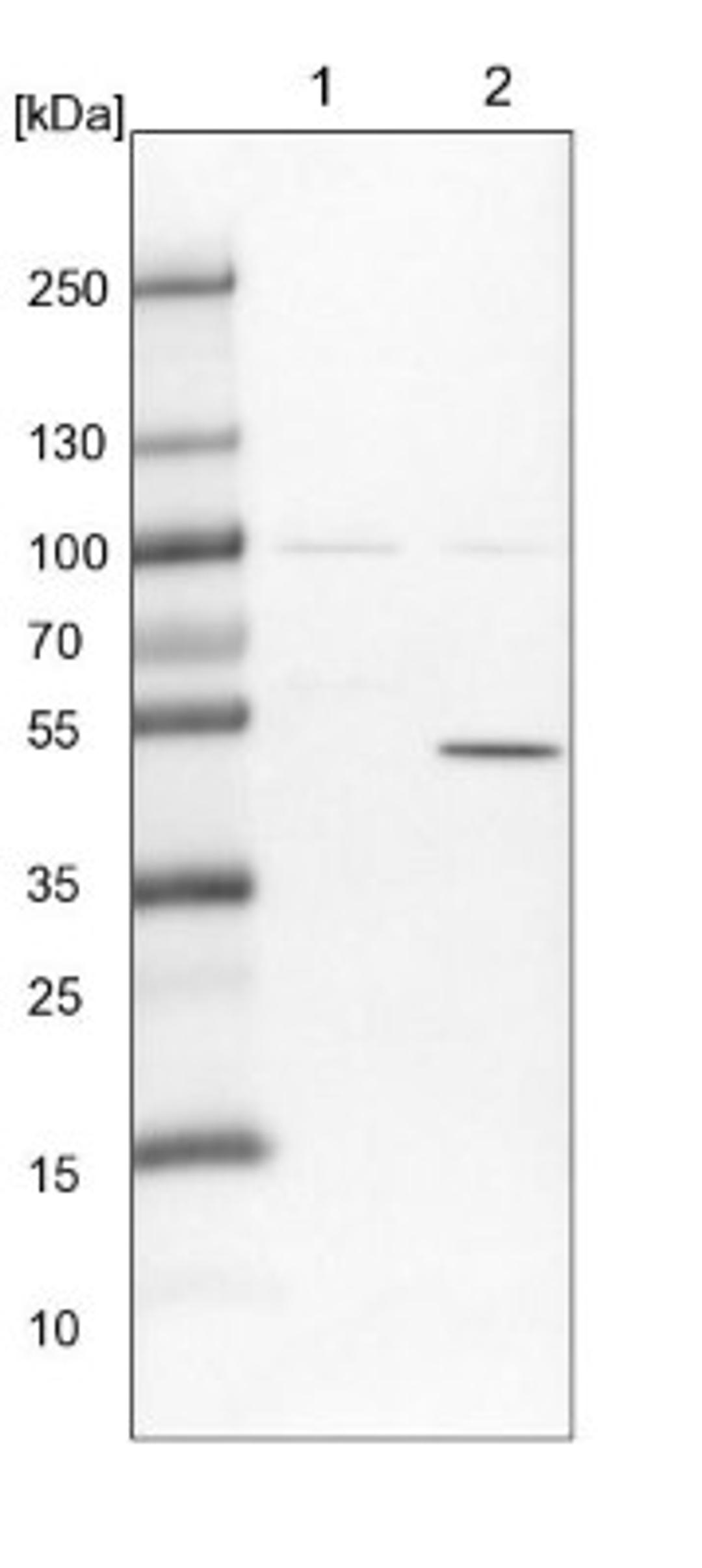 Western Blot: TTC38 Antibody [NBP1-82163] - Lane 1: NIH-3T3 cell lysate (Mouse embryonic fibroblast cells)<br/>Lane 2: NBT-II cell lysate (Rat Wistar bladder tumour cells)