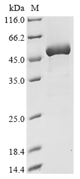 (Tris-Glycine gel) Discontinuous SDS-PAGE (reduced) with 5% enrichment gel and 15% separation gel.