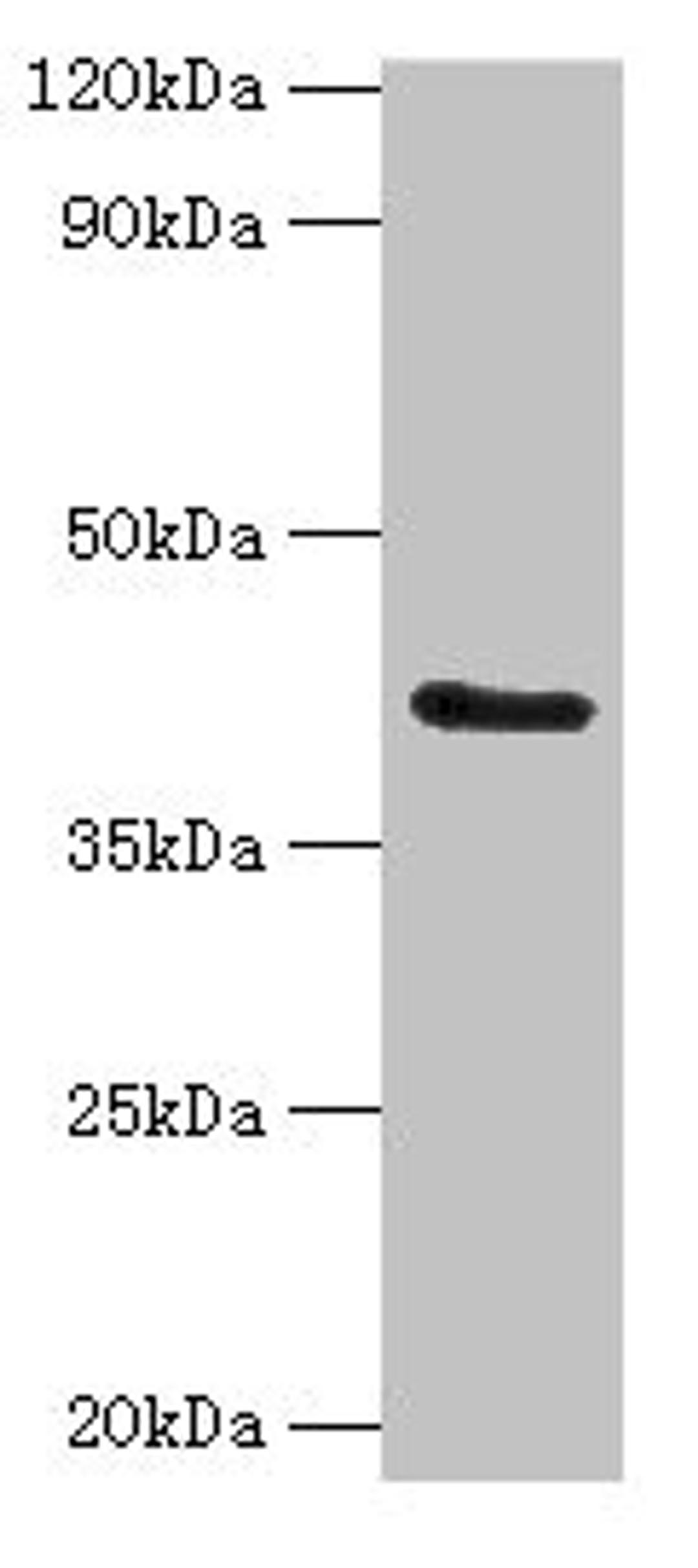 Western blot. All lanes: FUT6 antibody at 4ug/ml + Hela whole cell lysate. Secondary. Goat polyclonal to rabbit IgG at 1/10000 dilution. Predicted band size: 42, 43 kDa. Observed band size: 42 kDa. 