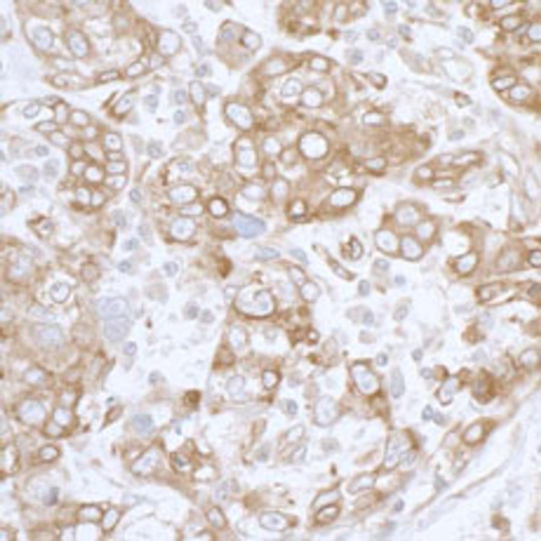 Detection of human PGRMC1 by immunohistochemistry.