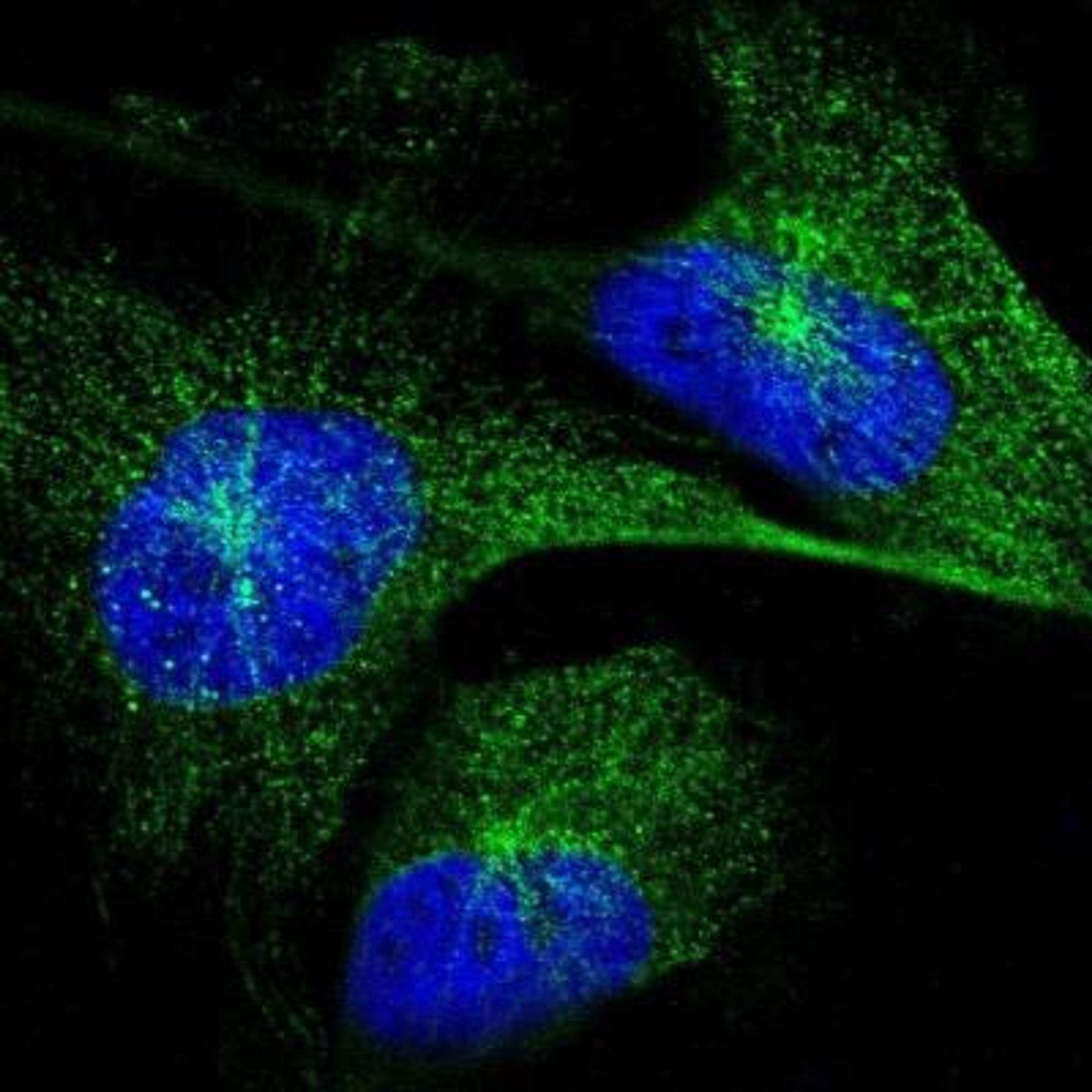 Immunocytochemistry/Immunofluorescence: CD39/ENTPD1 Antibody [NBP1-90071] - CD39 Antibody [NBP1-90071] - Staining of human cell line U-251MG shows positivity in cytoskeleton (microtubules).