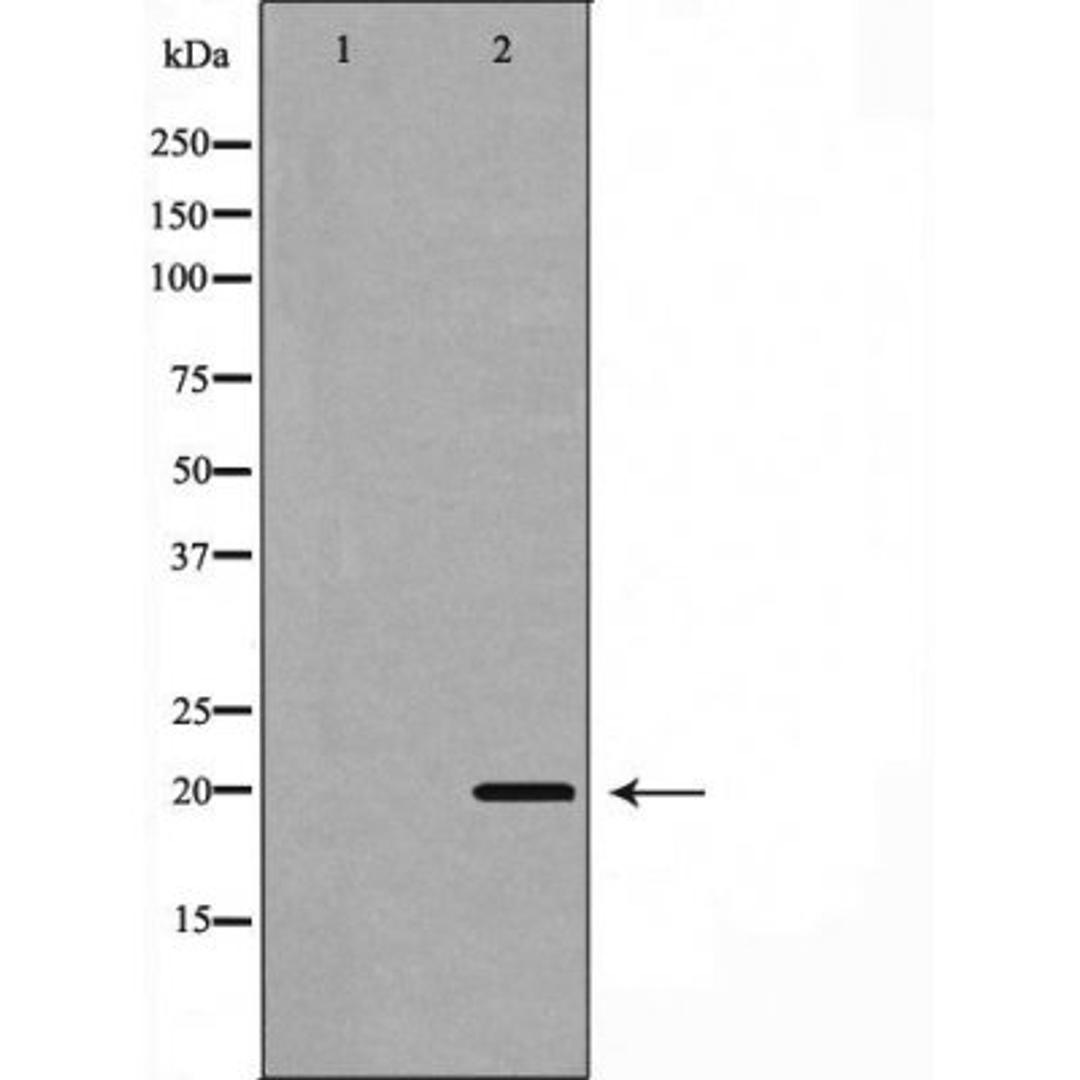 Western blot analysis of 293 cells using BBC3(PUMA) antibody