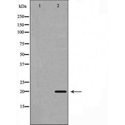 Western blot analysis of 293 cells using BBC3(PUMA) antibody